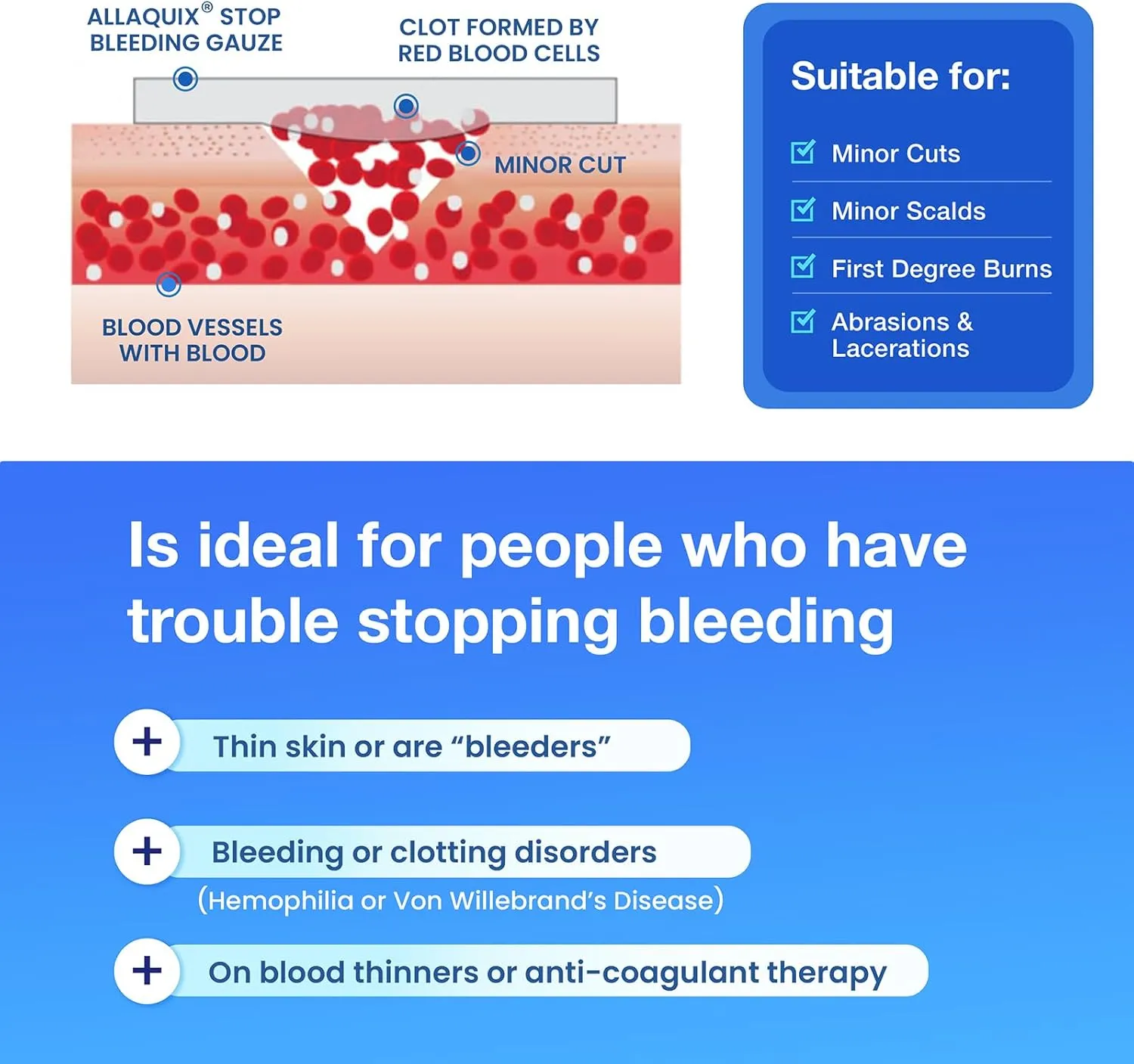 High Performance Stop Bleeding Gauze Pads – 10-Pack (2"x2") | Hemostatic Wound Dressing for Cuts & First Aid Kits | Sterile, Drug-Free, Fast Clotting Pads